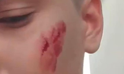 CISTERNA DI LATINA: AGGRESSIONE OMOFOBA, LE INDAGINI