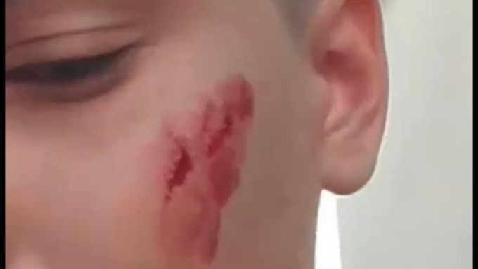 CISTERNA DI LATINA: AGGRESSIONE OMOFOBA, LE INDAGINI