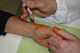 LATINA: INFILTRAZIONI PERITENDINEE, LA TERAPIA