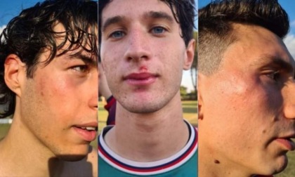 CALCIO UNDER 19: DOGANELLA-LA SETINA, PESANTI SQUALIFICHE.