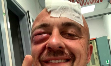 CASSINO: CHEF RUBIO AGGREDITO SOTTO CASA