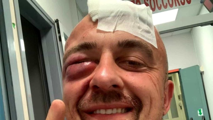 CASSINO: CHEF RUBIO AGGREDITO SOTTO CASA