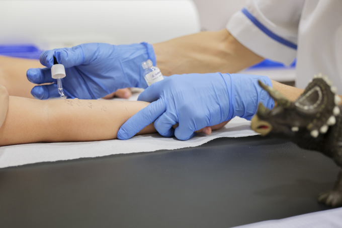 Allergie alimentari, nuovo test del sangue al Bambino Gesù