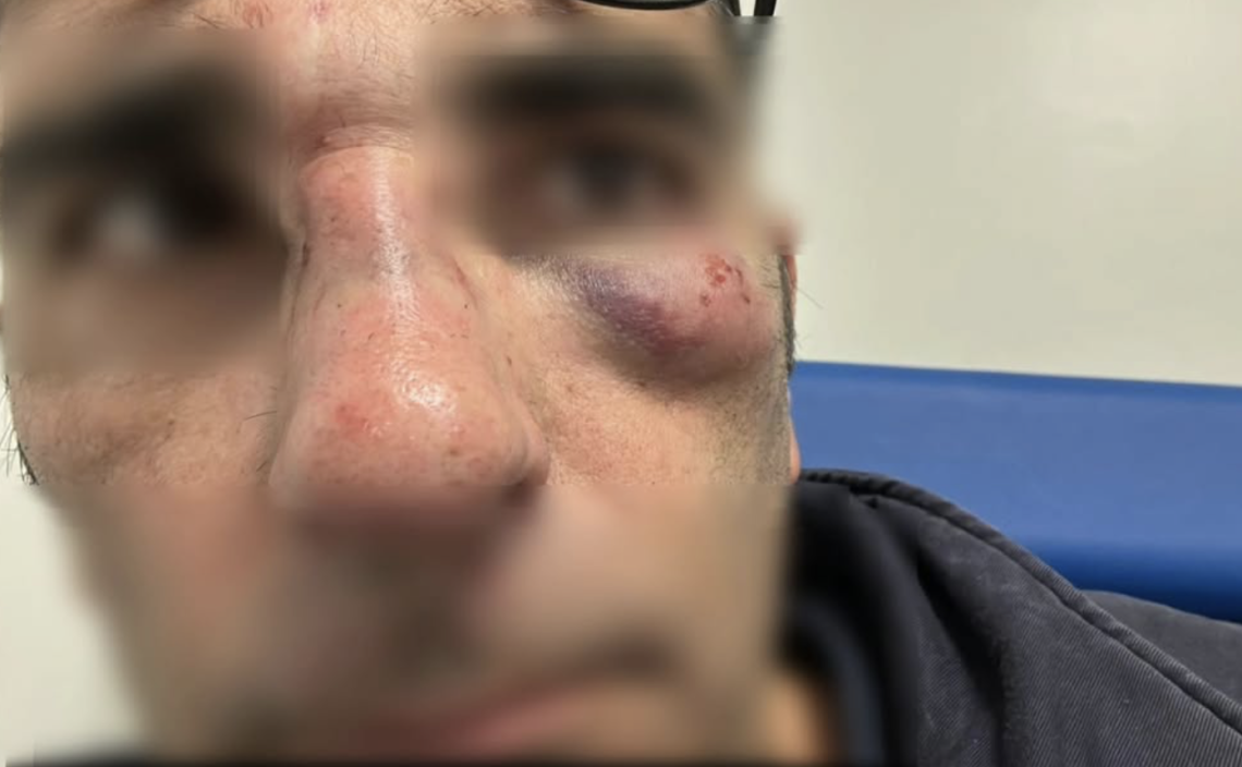 “Mi hanno colpito al volto senza motivo”, la testimonianza del controllore Cotral aggredito