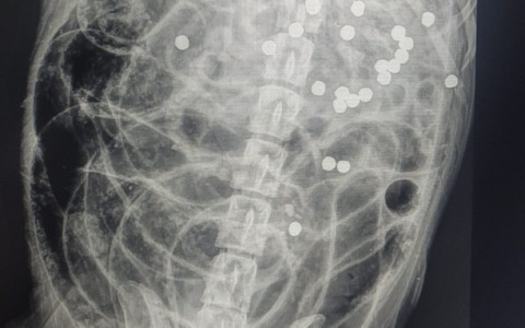 Cane ucciso da un colpo di fucile, intervengono le associazioni