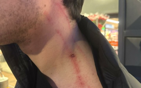 Studente aggredito alla stazione ferroviaria. L’appello del padre