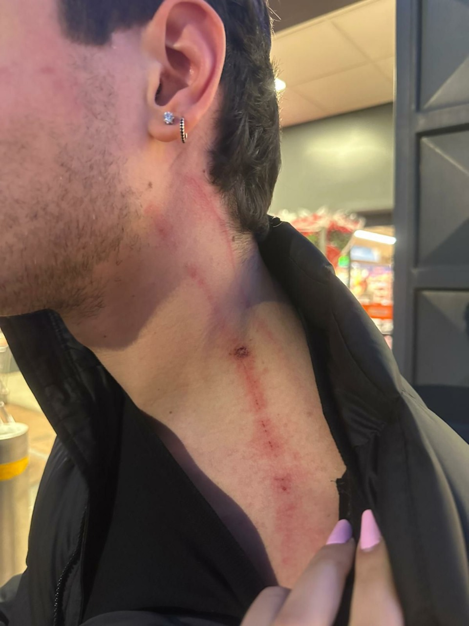 Studente aggredito alla stazione ferroviaria. L’appello del padre