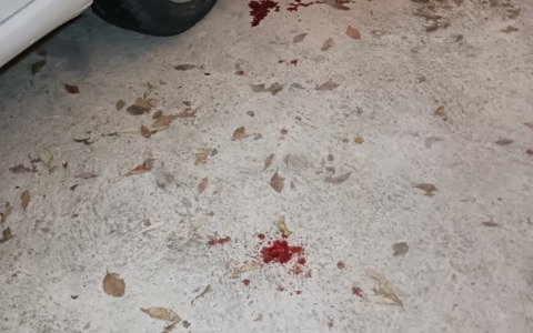 Tre rapine in tre settimane, il tabaccaio finito in ospedale: “Comprero’ una pistola per difendermi”