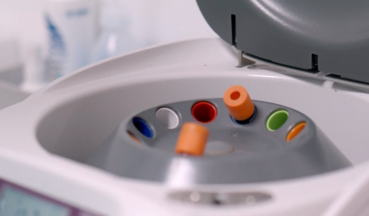 Mieloma multiplo, l’aspettativa di vita è salita ad oltre 10 anni