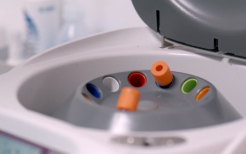 Mieloma multiplo, l’aspettativa di vita è salita ad oltre 10 anni