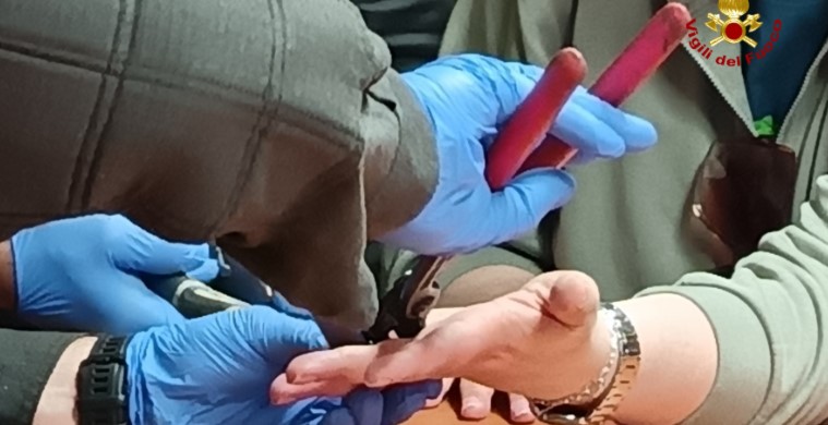 Si incastra l’anello, necessario l’intervento dei Vigili del Fuoco
