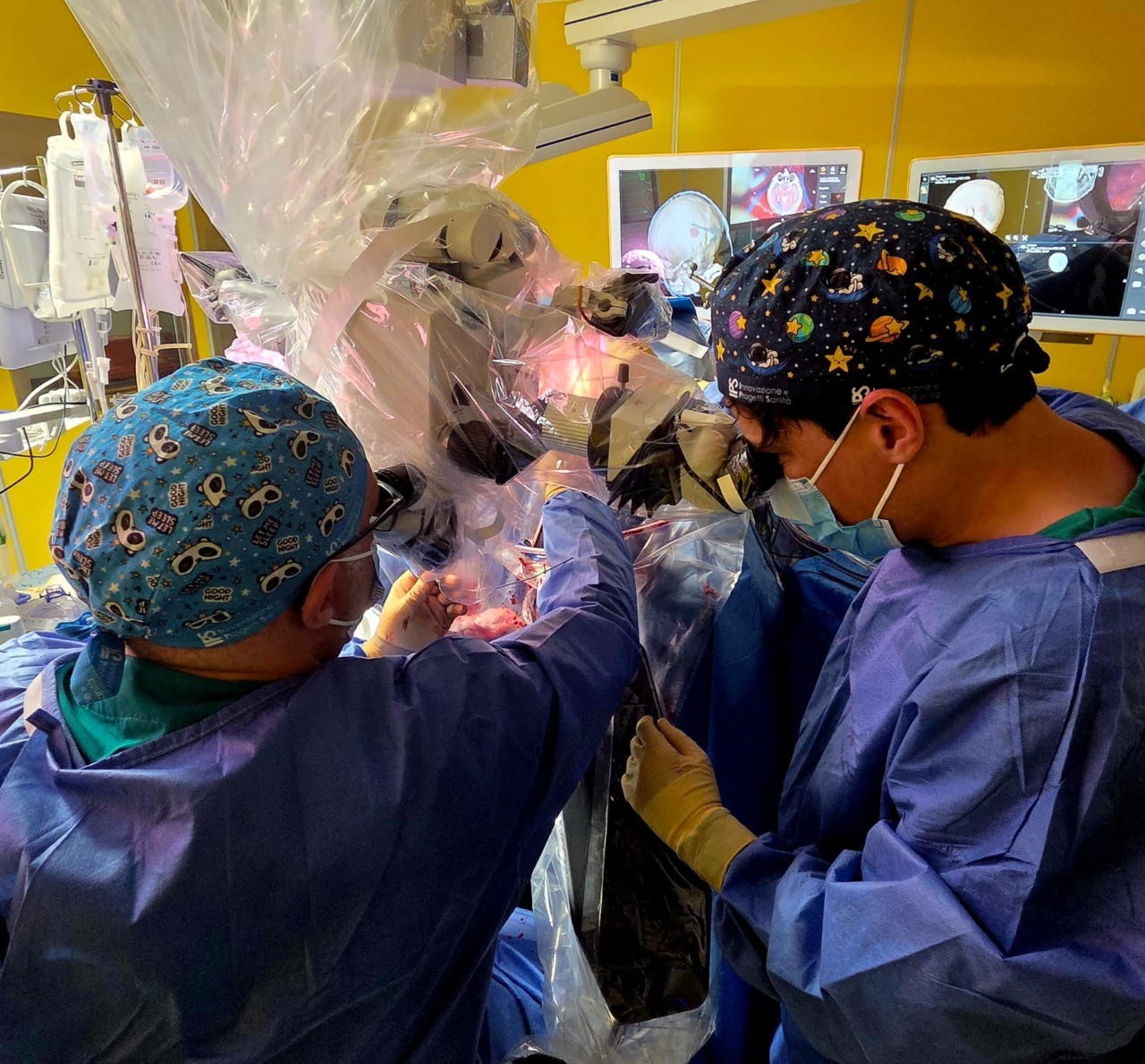 Rimosso un raro meningioma con un intervento neurochirurgico  ad altissima complessità allo Spaziani