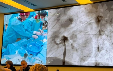Cardiologia, il Goretti fa scuola nella chiusura del forame ovale pelvio
